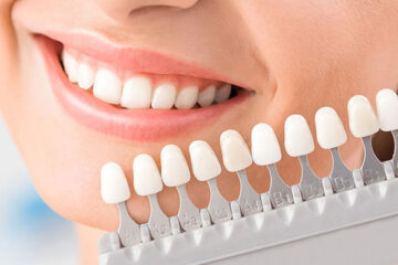 Cosmetic Dentist transformations