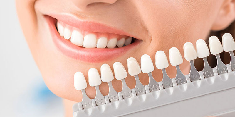 Cosmetic Dentist transformations