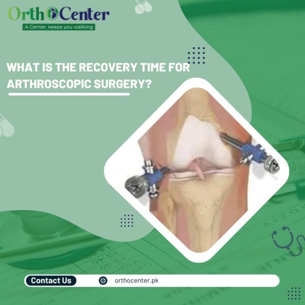 What is The Recovery Time for Arthroscopic Surgery?