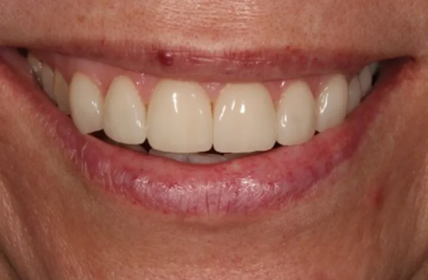 Transform Your Smile Today Discover Top Cosmetic Dentistry Options in Wirral 