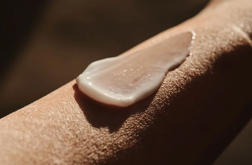 Why a Specialised Cream is Essential for Managing Very Dry Skin