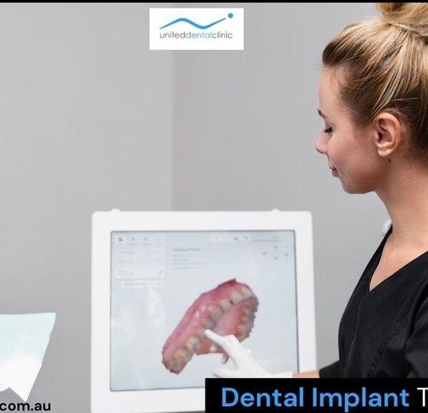 What to Expect in Dental Implant Technology in 2024?