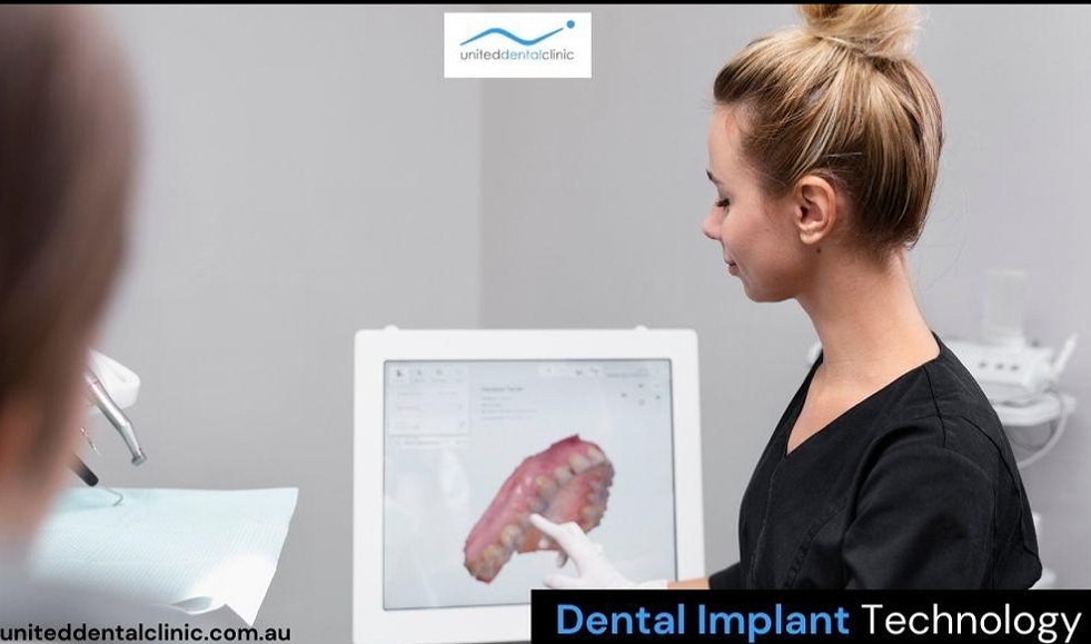 What to Expect in Dental Implant Technology in 2024?