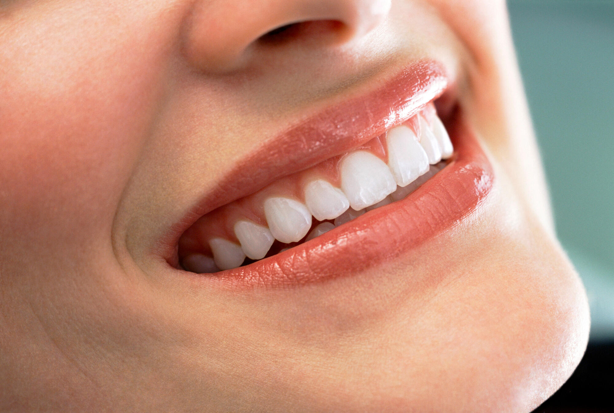 Exploring the Signs of Unhealthy Gums That Could Lead to Gum Recession