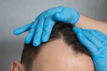 The Science Behind Effective Hair Growth Solutions in 2025