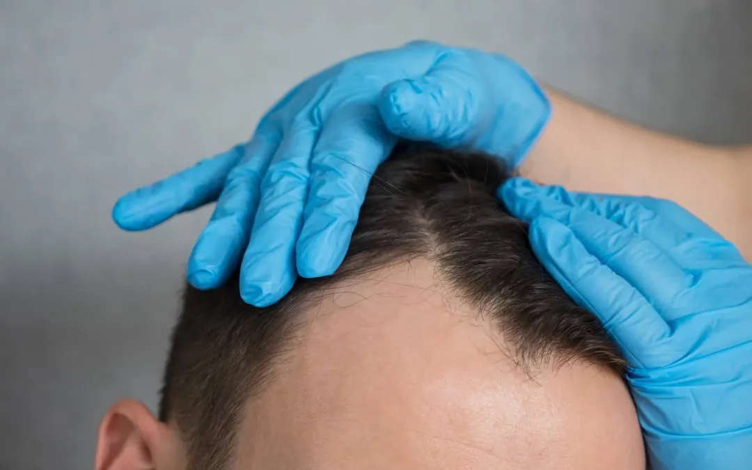 The Science Behind Effective Hair Growth Solutions in 2025